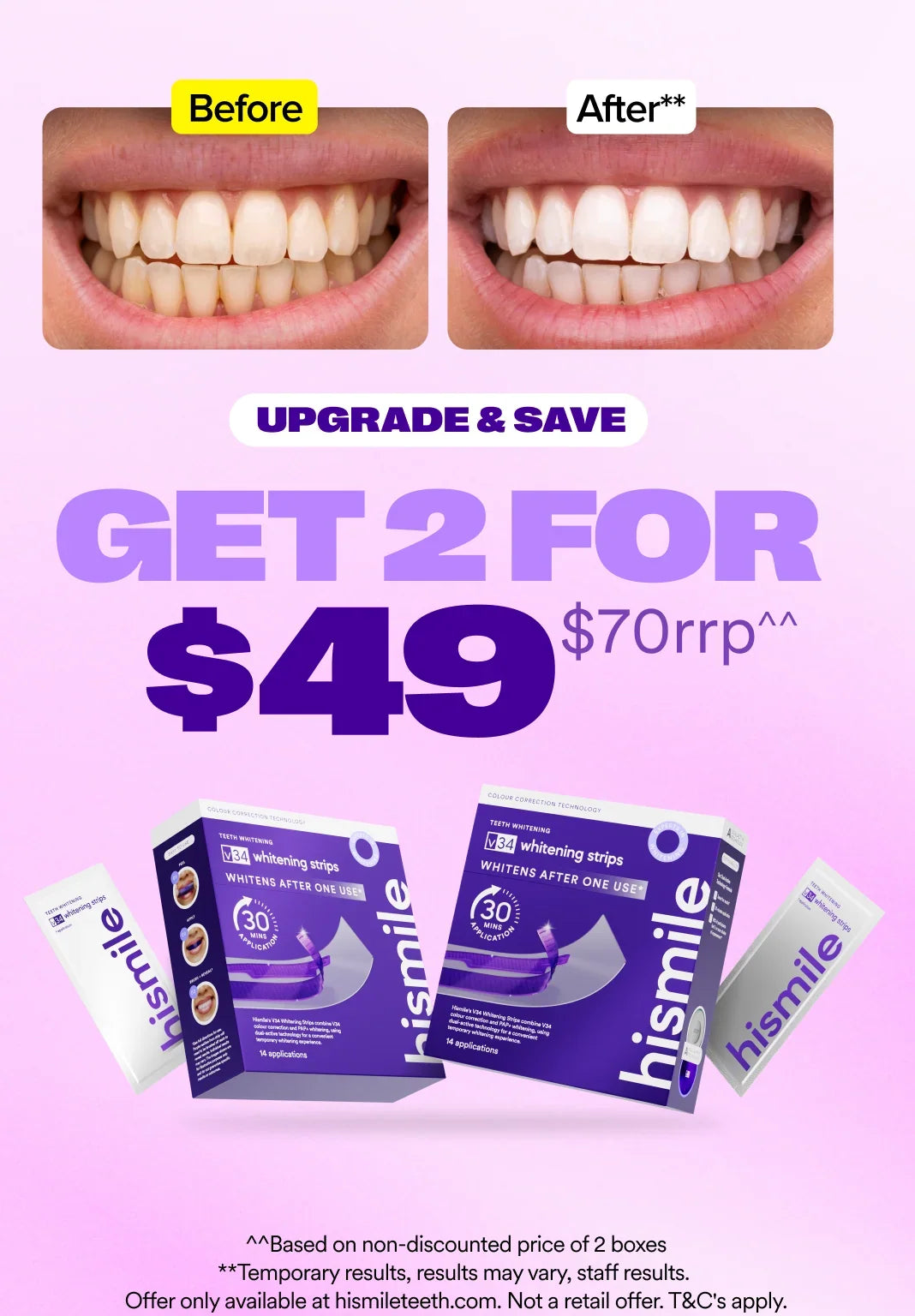 hismilewhiteningkit.it.com