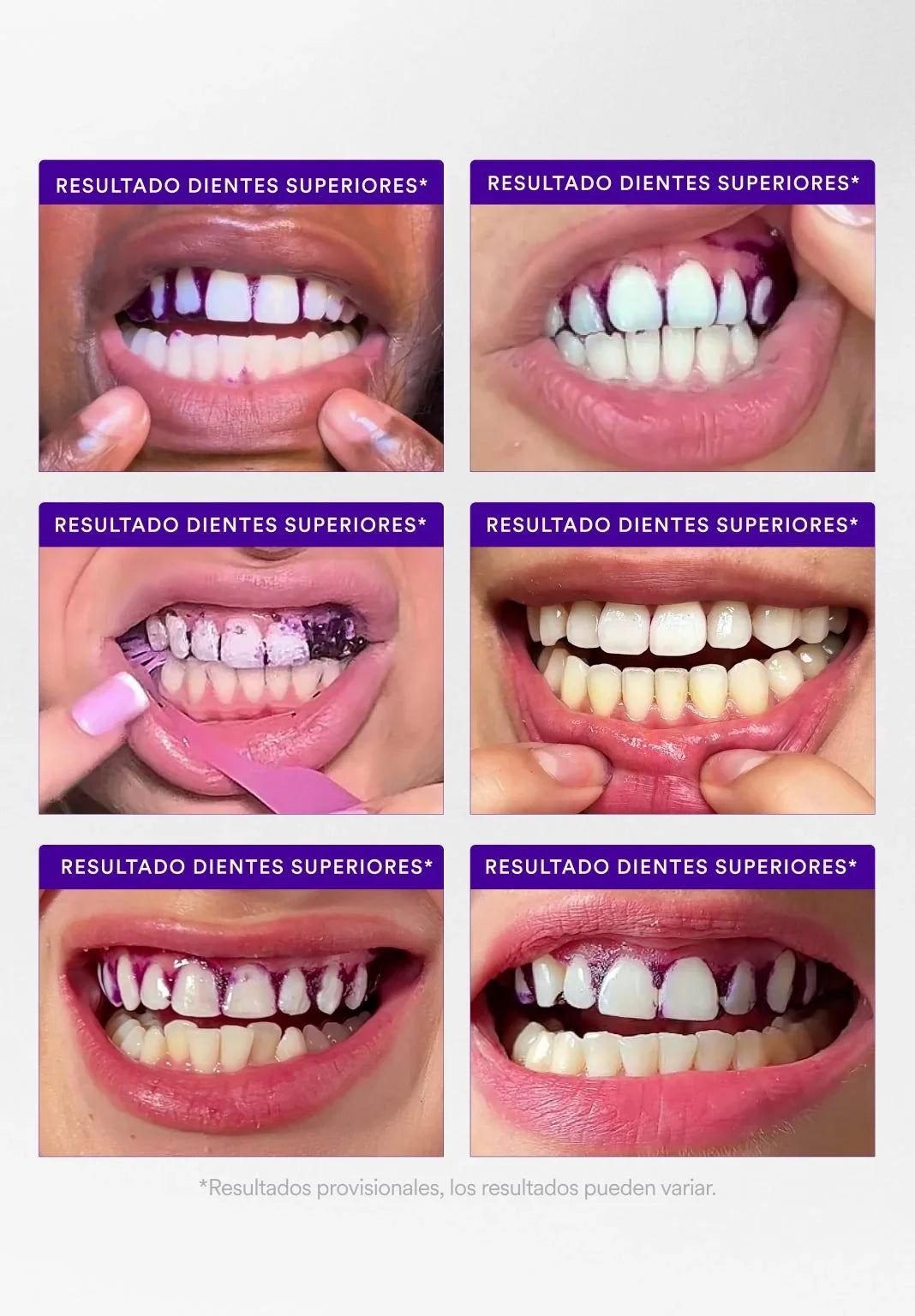 hismilewhiteningkit.it.com